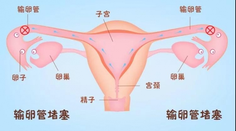 深度分析：为什么在揭阳医院做借卵试管婴儿好？