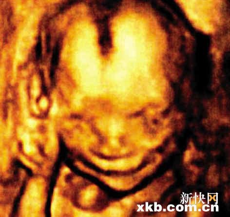 供卵试管婴儿期间男方应该做什么？
