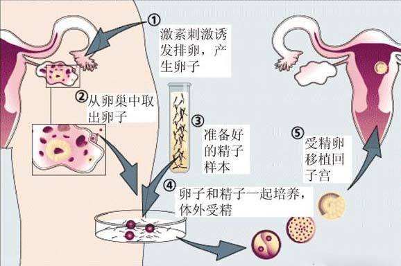 吉林冻卵费用是多少需要哪些条件