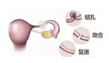 如何提高试管婴儿的成功率？