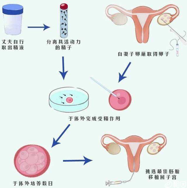 是不是胚胎等级越高？广州二胎代生成功率就越高+
