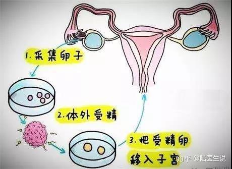 试管连续移植好不好