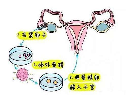 子宫内膜薄广州市代生咨询攻略告诉你如何调理