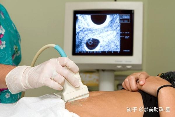 代怀孩子价格无痛取卵怎样操作