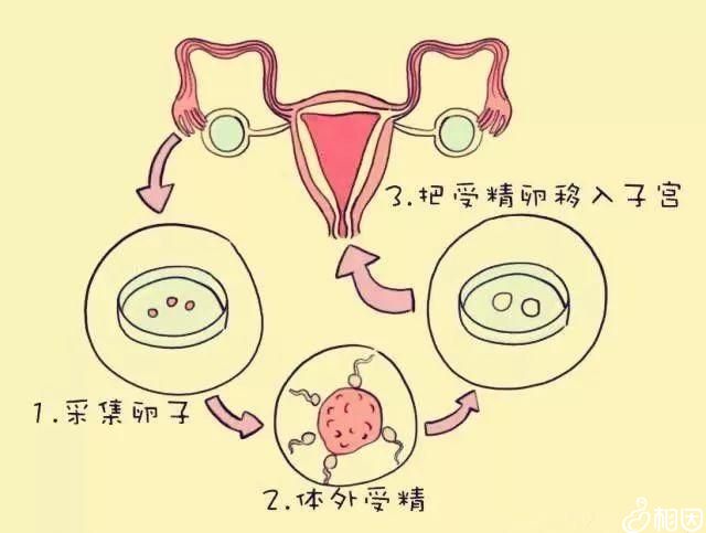 试管代怀在线咨询可以在精子库买精子