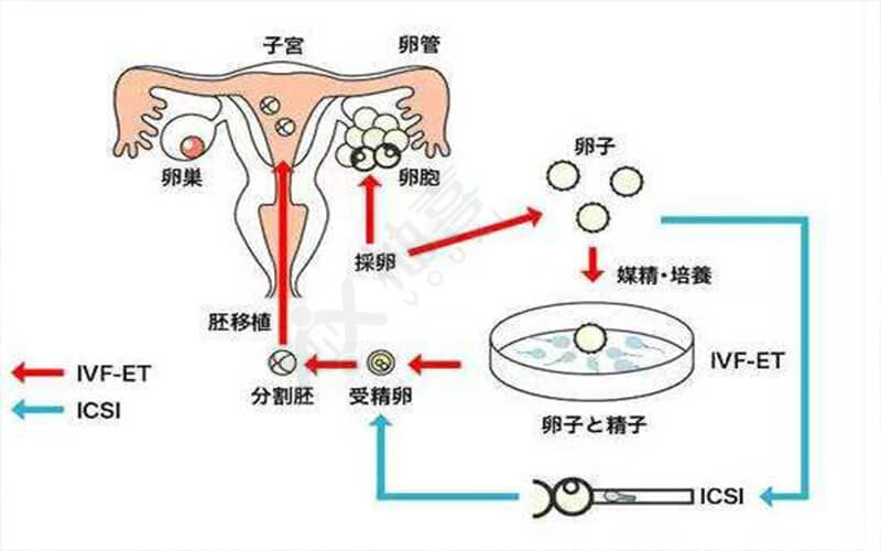 试管怀龙凤双胞胎对女性身体好不好