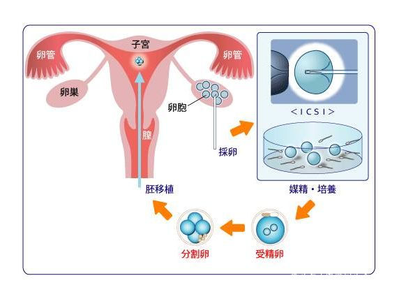 正规试管生子多少钱婴儿费用需要多少钱
