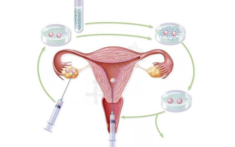 正规试管生子多少钱婴儿费用需要多少钱