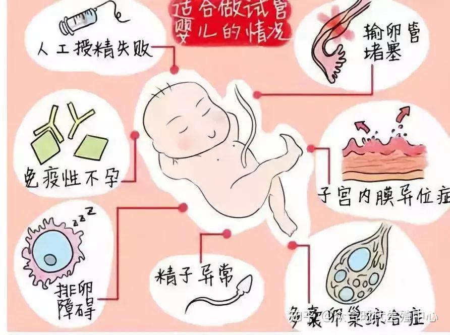绝育后还能生育吗（复通要怎么做？）